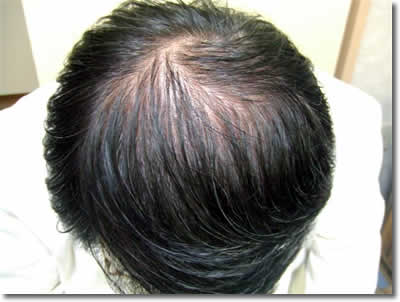「頭髪実験」2007年6月-1