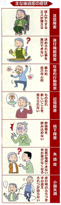 熱中症　主な後遺症