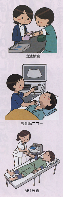 動脈硬化