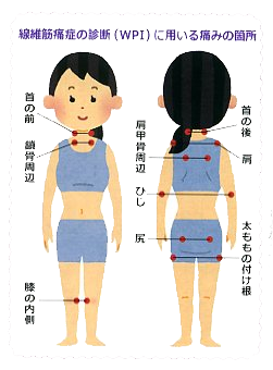 繊維繊維 イラスト