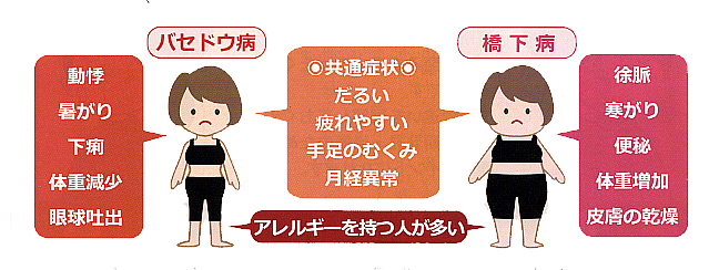 甲状腺疾患とアレルギーの関係　イラスト