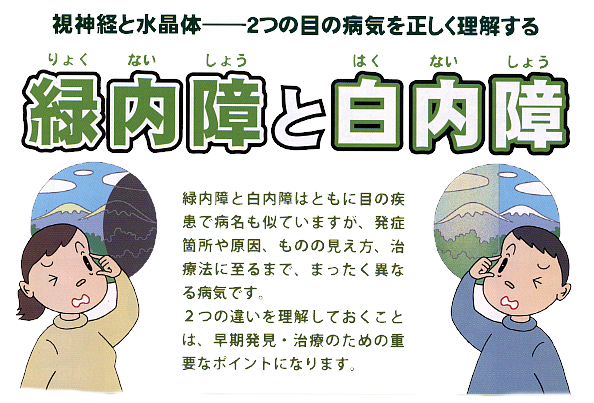 緑内障と白内障　イラスト